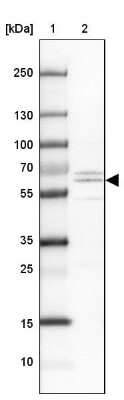 Western Blot: MIDN Antibody [NBP2-30437]