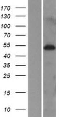 Western Blot: MIDN Overexpression Lysate [NBP2-05031]