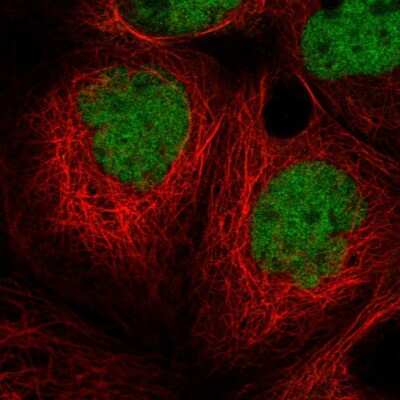 Immunocytochemistry/ Immunofluorescence: MIER1 Antibody [NBP2-55642]