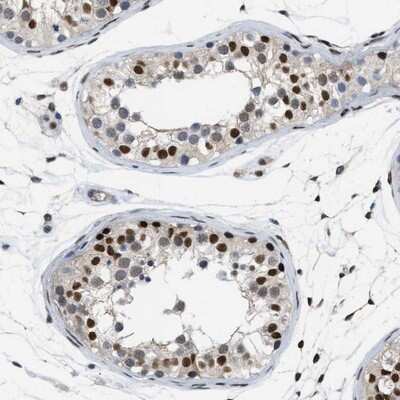 Immunohistochemistry-Paraffin: MIER1 Antibody [NBP1-81730]