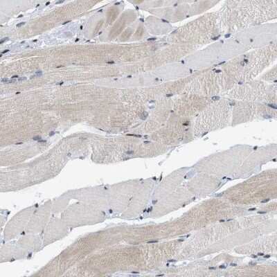 Immunohistochemistry-Paraffin: MIER1 Antibody [NBP1-81730]
