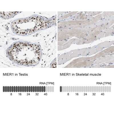 Immunohistochemistry-Paraffin: MIER1 Antibody [NBP1-81730]