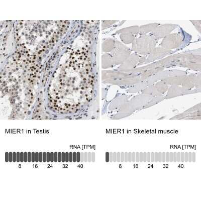 Immunohistochemistry-Paraffin: MIER1 Antibody [NBP1-81730]