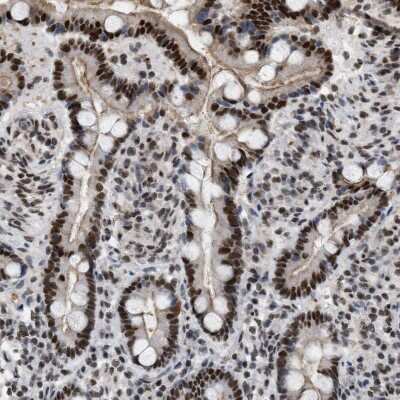 Immunohistochemistry-Paraffin: MIER1 Antibody [NBP1-81730]