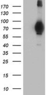 Western Blot: MIER2 Antibody (OTI3G7) [NBP2-01748]