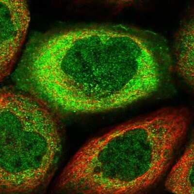 Immunocytochemistry/ Immunofluorescence: MIER2 Antibody [NBP2-47372]