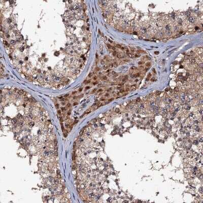 Immunohistochemistry-Paraffin: MIER2 Antibody [NBP2-47372]
