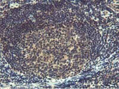 Immunohistochemistry: MIER2 Antibody (OTI3G7) - Azide and BSA Free [NBP2-72683]