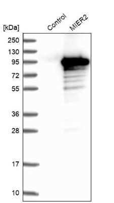 Western Blot: MIER2 Antibody [NBP2-47372]