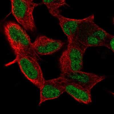 Immunocytochemistry/ Immunofluorescence: MIER3 Antibody [NBP2-38080]