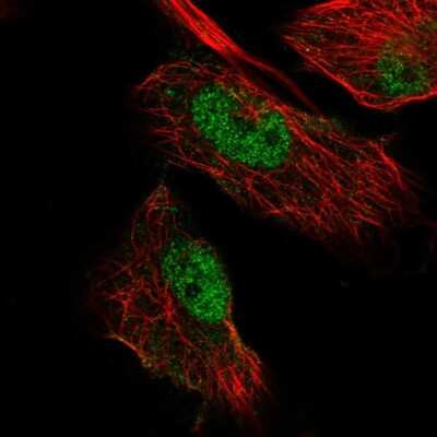 Immunocytochemistry/ Immunofluorescence: MIER3 Antibody [NBP2-58160]