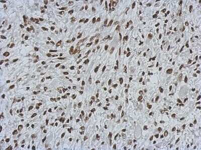 Immunohistochemistry-Paraffin: MIER3 Antibody [NBP2-17290]