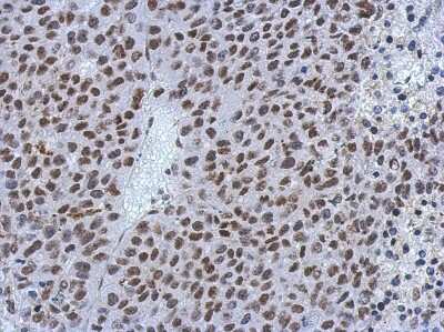 Immunohistochemistry-Paraffin: MIER3 Antibody [NBP2-17290]