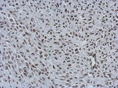 Immunohistochemistry-Paraffin: MIER3 Antibody [NBP2-17290]