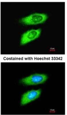 Immunocytochemistry/ Immunofluorescence: MIF Antibody [NBP1-32192]