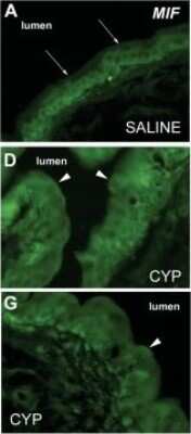 Immunohistochemistry: MIF Antibody [NB100-1789]
