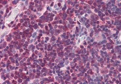 Immunohistochemistry-Paraffin: MIF Antibody [NB100-1789]