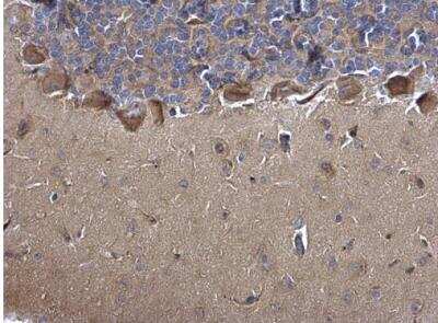 Immunohistochemistry-Paraffin: MIF Antibody [NBP1-32192]