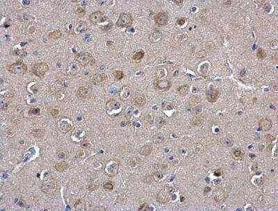 Immunohistochemistry-Paraffin: MIF Antibody [NBP1-32192]