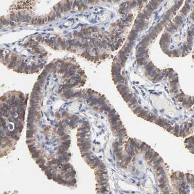 Immunohistochemistry-Paraffin: MIF Antibody [NBP1-81832]
