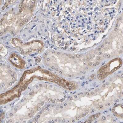 Immunohistochemistry-Paraffin: MIF Antibody [NBP1-81832]