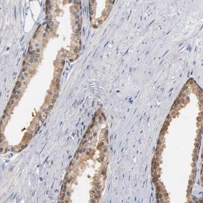 Immunohistochemistry-Paraffin: MIF Antibody [NBP1-81832]