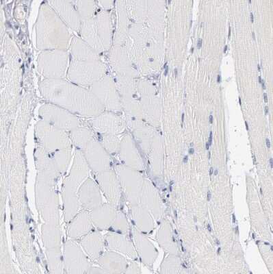 Immunohistochemistry-Paraffin: MIF Antibody [NBP1-81832]