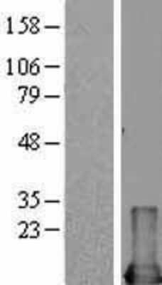 Western Blot: MIF Overexpression Lysate [NBL1-13108]