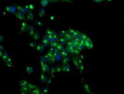 Immunocytochemistry/ Immunofluorescence: MIF4GD Antibody (OTI4C11) [NBP2-01876]