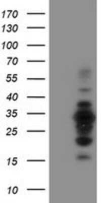 Western Blot: MIF4GD Antibody (OTI4C11) [NBP2-01876]