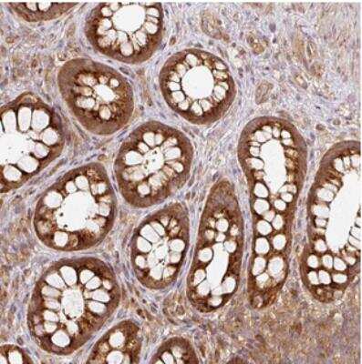 Immunohistochemistry-Paraffin: MIF4GD Antibody [NBP2-30627]