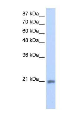 Western Blot: MIF4GD Antibody [NBP1-57562]