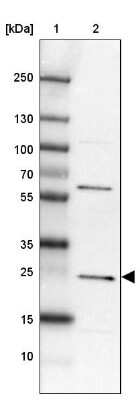 Western Blot: MIF4GD Antibody [NBP2-30627]