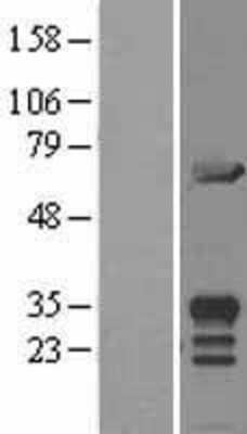 Western Blot: MIF4GD Overexpression Lysate [NBL1-13109]