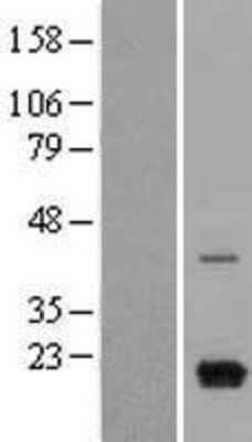 Western Blot: CXCL9/MIG Overexpression Lysate [NBL1-09630]