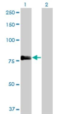 Western Blot: MIG2/Kindlin-2 Antibody (2G11) [H00010979-M09]