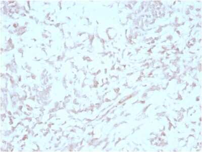 Immunohistochemistry-Paraffin: MIG2/Kindlin-2 Antibody (3A3) [NBP3-13846]