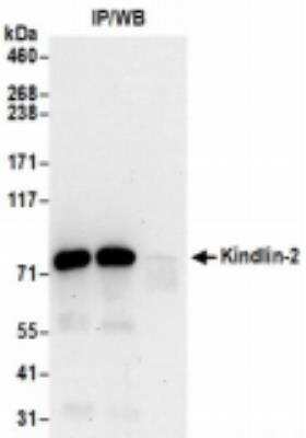 Immunoprecipitation: MIG2/Kindlin-2 Antibody [NBP2-36541]