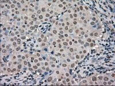 Immunohistochemistry: MIG2/Kindlin-2 Antibody (OTI9E4) - Azide and BSA Free [NBP2-72687]