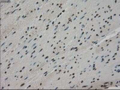 Immunohistochemistry: MIG2/Kindlin-2 Antibody (OTI9E4) - Azide and BSA Free [NBP2-72687]