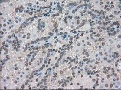 Immunohistochemistry: MIG2/Kindlin-2 Antibody (OTI9E4) - Azide and BSA Free [NBP2-72687]