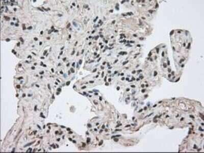 Immunohistochemistry: MIG2/Kindlin-2 Antibody (OTI9E4) - Azide and BSA Free [NBP2-72687]