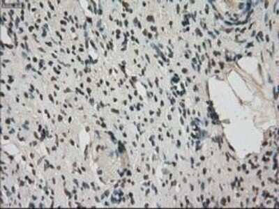 Immunohistochemistry: MIG2/Kindlin-2 Antibody (OTI9E4) - Azide and BSA Free [NBP2-72687]