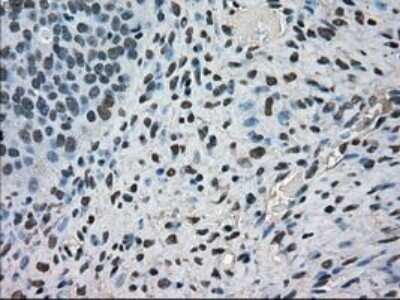 Immunohistochemistry: MIG2/Kindlin-2 Antibody (OTI9E4) - Azide and BSA Free [NBP2-72687]