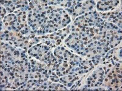 Immunohistochemistry: MIG2/Kindlin-2 Antibody (OTI9E4) - Azide and BSA Free [NBP2-72687]