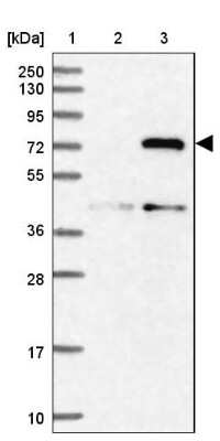 Western Blot: MIG2/Kindlin-2 Antibody [NBP1-87884]