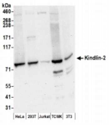 Western Blot: MIG2/Kindlin-2 Antibody [NBP2-36541]