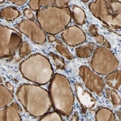 Immunohistochemistry-Paraffin: MINA Antibody [NBP1-89862]