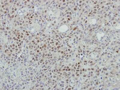 Immunohistochemistry-Paraffin: MINA Antibody [NBP2-17292]