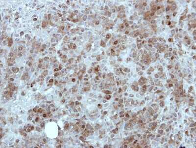 Immunohistochemistry-Paraffin: MINA Antibody [NBP2-17293]